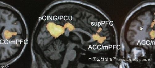 最新大脑扫描技术可精确揭晓人们所想事物